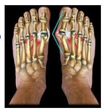 [Image: Downs foot.jpg]
